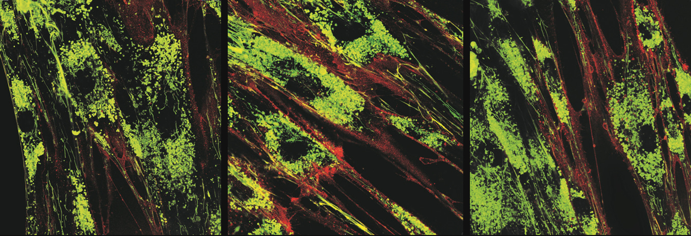 Mesenchymal stem cells after ESiNAR-X® treatment — internalized molecules light up in green