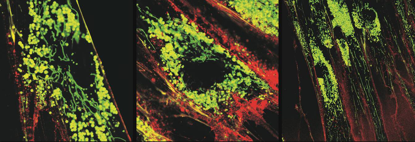 Fibroblasts after ESiNAR-X® treatment — internalized molecules light up in green